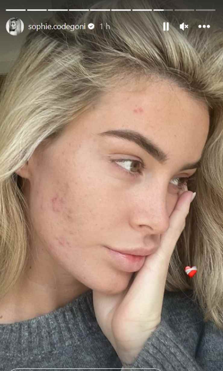 Sophie Codegoni acne